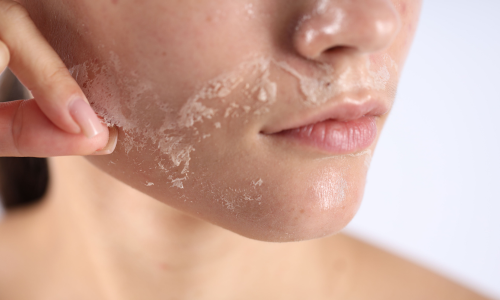 Dehydrated vs. Dry Skin: Why They Are Often Confused and How to Treat Them Correctly (2-3 MIN.)